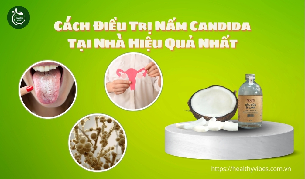 Cách Điều Trị Nấm Candida Tại Nhà Hiệu Quả Nhất